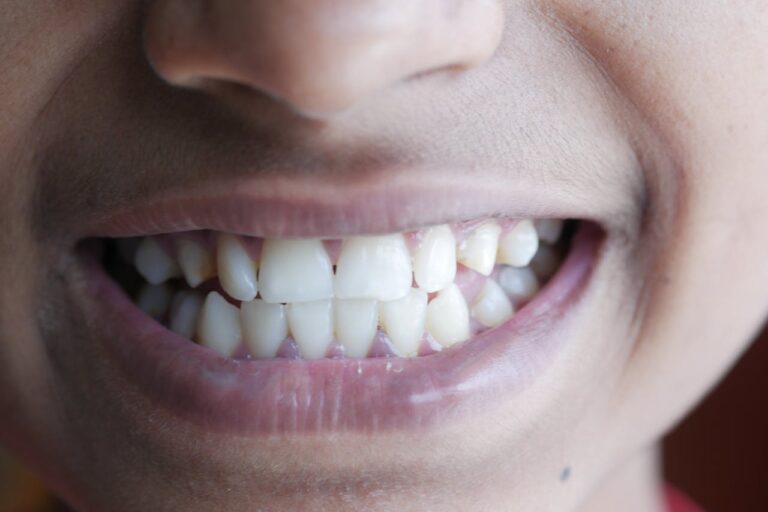 Breaking the Nail Biting Habit: Understanding the Risks and Solutions