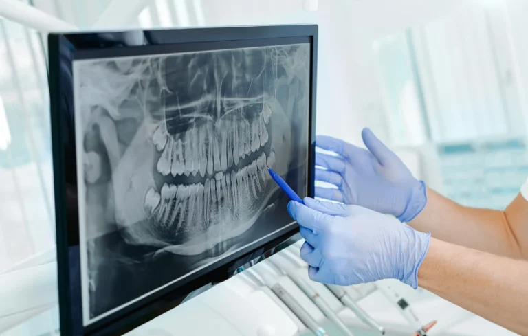 Exam & X-Rays
