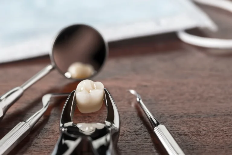 Wisdom Tooth Extractions