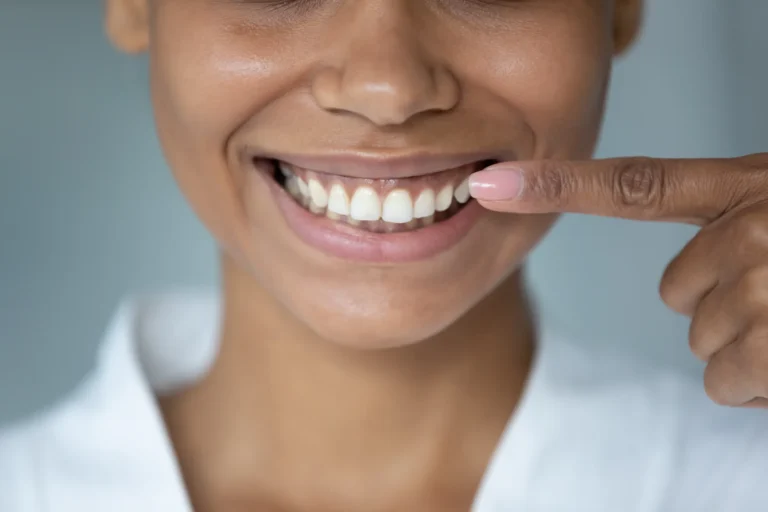 Frenectomy
