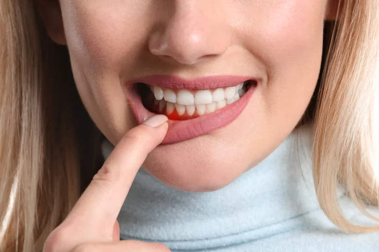 The Impact of Periodontal Disease on Dental Implant Success
