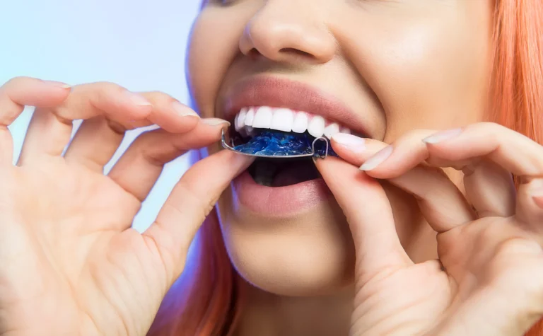 Retainers