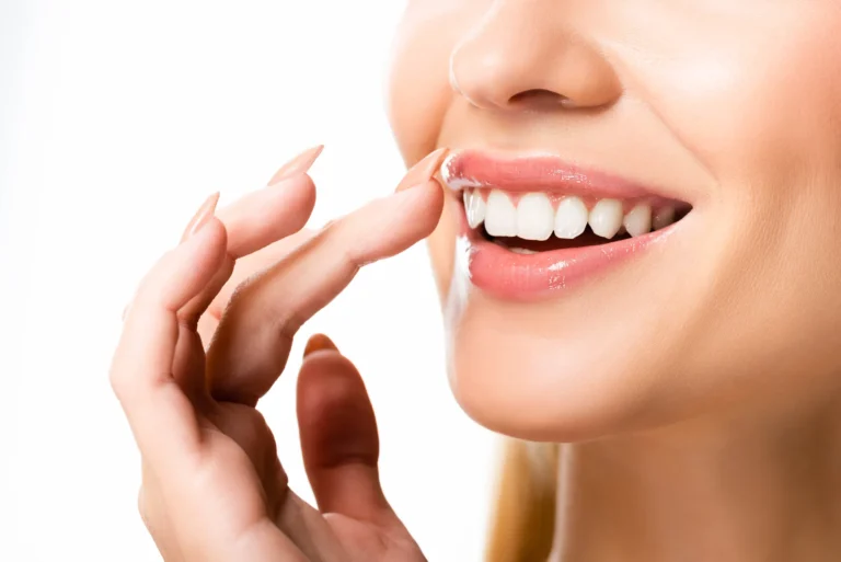 Veneers