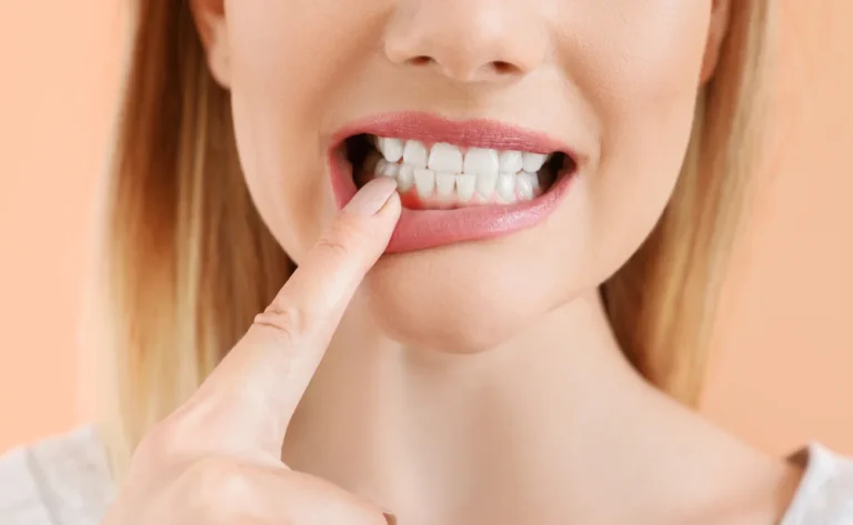 Periodontal Maintenance